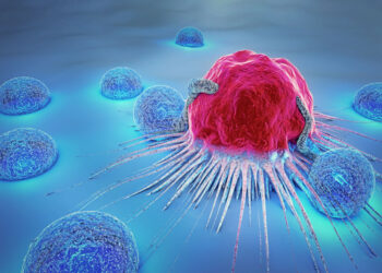 Мужчины в Украине чаще умирают от рака, чем женщины: главная причина