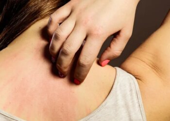 Массовая вспышка инфекции в школах Алчевска: оккупационные власти игнорируют угрозу