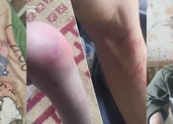 Діти серед бруду і голоду: шокуючі умови життя викрили на Київщині