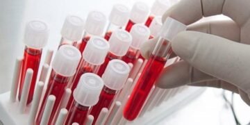 Скринінг здоров’я 40+ у Києві: приховані небезпеки можуть бути вже зараз