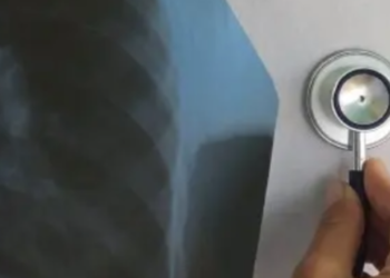 Київ під впливом небезпечних вірусів: динаміка захворюваності 