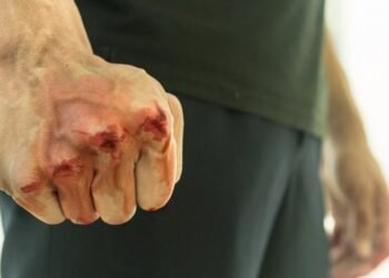Напад серед білого дня у Києві: доньку відомого журналіста вдарили на зупинці